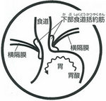 逆流性食道炎の説明